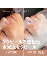 リコ 白金台(Liko)/