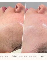 ビジ(biji)/肌本来の輝きへ