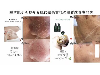 ルミナエステ(LUMINA ESTH)の写真