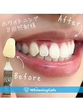 ホワイトニングカフェ 苫小牧店(WhiteningCafe)/ ◎歯のホワイトニング施術写真
