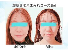 ヨサパーク ココロ 町田店(YOSA PARK COCORO)/Beforeafter