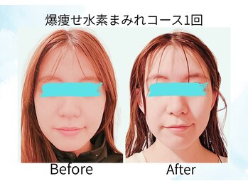 ヨサパーク ココロ 町田店(YOSA PARK COCORO)/Beforeafter