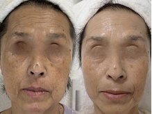 レイネ(REINE)の雰囲気（フェイシャルエステやお顔のワックス脱毛で若々しいお肌へ◎）