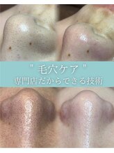 シェリール 浦和店(cherir)&nbsp;毛穴ケアに 拘りの技術