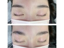 リアン/ハリウッドブロウリフト