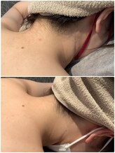 ディオーネ 春日井勝川店(Dione)/ビフォーアフター