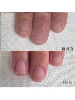 メイル(MEILU)/健康美爪育成コースによって