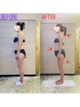 エステティックサロン アール 大阪梅田(esthetic salon R)/40代女性　横