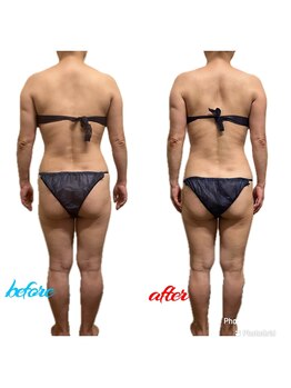 スマイルボディ つぼの森 加治木店(Smile body)/メディセル☆全身