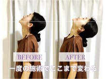 ハリティブ(HARITIVE)の雰囲気（大人気！首/肩/腰痛スッキリコースで頭が無重力になった感覚を！）