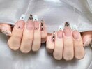 スカルプ長さだし10本デザイン