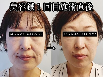 アオヤマ サロン ワイゼット(AOYAMA SALON YZ)の写真