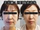 アオヤマ サロン ワイゼット(AOYAMA SALON YZ)の写真
