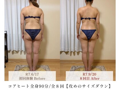 コアヒート専門温活エステサロン yunari 【ユナリ】の写真