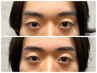 眉スタイリング＋ハリウッドブロウリフト＋ヘッドスパ（炭酸泉・美容液込み）