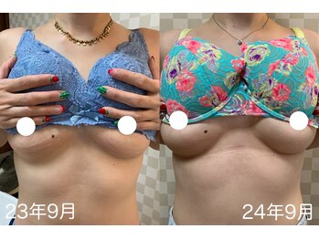 ハレオラ(HaleOla)/30代☆他サロンでは育たなかった