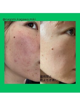 木の葉/若よもぎ蒸し（美・オーダーA）