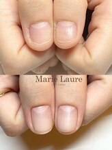 マリーロール 梅田店(Marie Laure)/深爪矯正/自爪育成/自爪風
