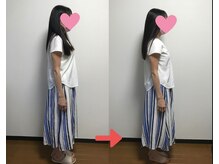 ヌフヌフ(neuf neuf)の雰囲気（肩こりの方、施術後肩が開きます）