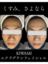 リヴィア(LIVIA)/引き上げながらくすみを一層！