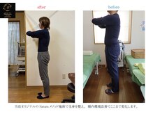 からだととのう ナチュラプレミアム アカサカ(Natura premier akasaka)/実証結果/エイジングケア