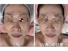 アルページュ(Arpege)の雰囲気（40代～も好評シミ肌ムラを分解◎一撃クリア♪ぷるん美白ベビー）