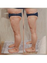 カルナボディ(Carna body.)/洋服が似合う！綺麗に下半身痩せ