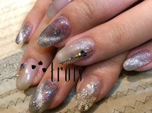 トロワ 中目黒(trois)/深爪矯正のお客様