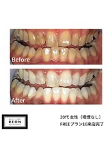 レオン 磐田(REON)/◇ お客様 before＆after ◇