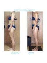 ラヴィソンファム(Ravissant femme)/痩身エステ/ビフォー＆アフター