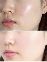 モッド(MOD)/ヴァルモン