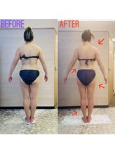 エステティックサロン アール 大阪梅田(esthetic salon R)/40代女性　後