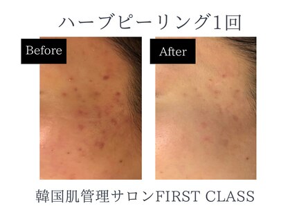 ファーストクラス(FIRST CLASS)の写真