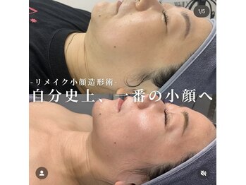 リメイク 銀座(REMAKE)/★リフトアップ小顔フル工程90分