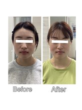 シンメトリー 千葉店/顔の印象が変わります！