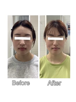 シンメトリー 千葉店/顔の印象が変わります!