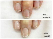 キアラネイル(Chiala nail)/自爪育成