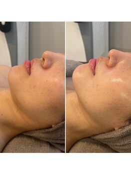 リリー(LILY)/韓国美容 LILY