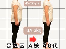 楽陽堂鍼灸院/足立区 A様 40代 痩身プログラム