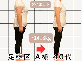 楽陽堂鍼灸院/足立区 A様 40代 痩身プログラム
