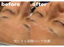 ホワイトラボ 堺東(White labo)/【40代女性 施術1回の効果】