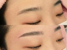 ジョアアンジェ 京橋店(joie ange)/【施術前後】HBL