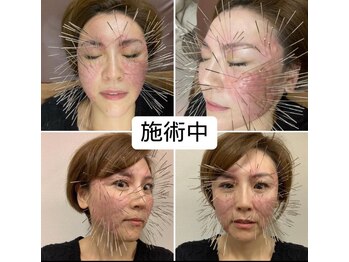 ランスソア(L'ins soi)/