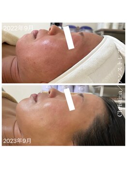 ルルボーテ(Loulou Beaute)/クリスティーナ/アンストレス