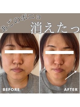 マヴィ 香里園店(MavY.)/リフトアップ筋膜リリース