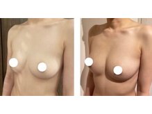 エスビューティー 三軒茶屋(S beauty)/バストケア・駒澤大学・痩身