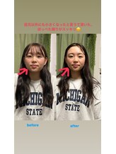 整体院りょう 高槻市/むくみ改善 &nbsp;肌質改善