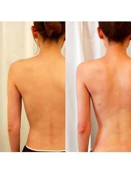 ミールーム(mi room)/ブライダルエステ3ヶ月半