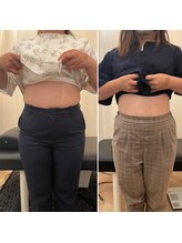 ナオ接骨院(NAO接骨院)/Before／After