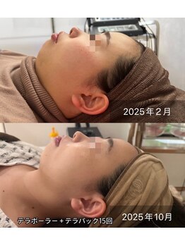 ルビーミー(Ruby's Me)/